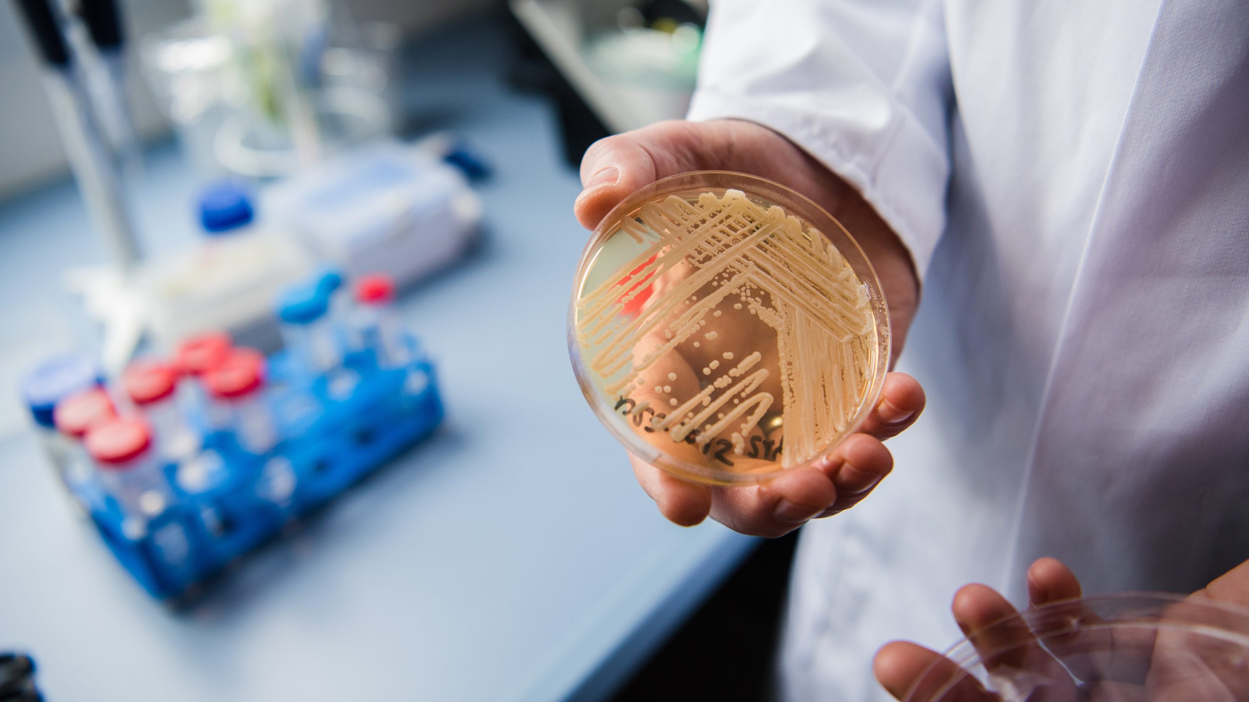 New study reveals why dangerous fungus is so difficult to treat — KTVU FOX 2 Bay Area, Napa Community news